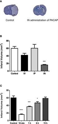 Intranasal Administration of PACAP Is an Efficient Delivery Route to Reduce Infarct Volume and Promote Functional Recovery After Transient and Permanent Middle Cerebral Artery Occlusion